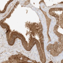 Xrn1 Antibody, Novus Biologicals 0.1mL; Unlabeled:Antibodies, Polyclonal